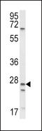 Sodium Channel Epithelial 1 Alpha Subunit antibody, LS-C162900, Lifespan Biosciences, Western Blot image 