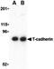 Cadherin 13 antibody, LS-B481, Lifespan Biosciences, Western Blot image 