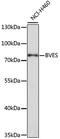 Blood vessel epicardial substance antibody, GTX30098, GeneTex, Western Blot image 