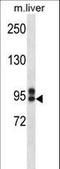 ATP Binding Cassette Subfamily C Member 12 antibody, LS-C155847, Lifespan Biosciences, Western Blot image 