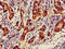 NAD(P)H Quinone Dehydrogenase 1 antibody, LS-C678849, Lifespan Biosciences, Immunohistochemistry paraffin image 