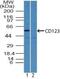 Interleukin 3 Receptor Subunit Alpha antibody, NBP2-27160, Novus Biologicals, Western Blot image 
