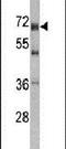 DEAD-Box Helicase 5 antibody, PA5-14367, Invitrogen Antibodies, Western Blot image 