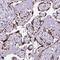 Jun-d antibody, HPA063029, Atlas Antibodies, Immunohistochemistry paraffin image 