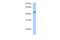 Ankyrin Repeat Domain 65 antibody, A18331, Boster Biological Technology, Western Blot image 