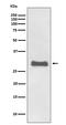 PRP antibody, M02447, Boster Biological Technology, Western Blot image 