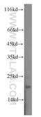 Stathmin-2 antibody, 10586-1-AP, Proteintech Group, Western Blot image 