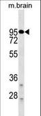 D(2) dopamine receptor antibody, LS-C159490, Lifespan Biosciences, Western Blot image 