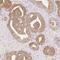 Bridging Integrator 3 antibody, FNab00899, FineTest, Immunohistochemistry paraffin image 