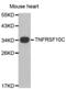 Tumor necrosis factor receptor superfamily member 10C antibody, abx001051, Abbexa, Western Blot image 