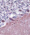 Adaptor Related Protein Complex 2 Subunit Alpha 1 antibody, 57-344, ProSci, Immunohistochemistry frozen image 