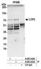 Lymphocyte Cytosolic Protein 2 antibody, A305-242A, Bethyl Labs, Immunoprecipitation image 
