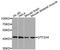 General Transcription Factor IIH Subunit 4 antibody, A10801, Boster Biological Technology, Western Blot image 