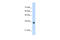 Homeobox B4 antibody, 29-085, ProSci, Western Blot image 