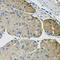 Thrombospondin 2 antibody, orb374696, Biorbyt, Immunohistochemistry paraffin image 