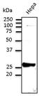 RAB9A, Member RAS Oncogene Family antibody, LS-C204237, Lifespan Biosciences, Western Blot image 