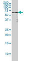 p65 antibody, LS-B13554, Lifespan Biosciences, Western Blot image 