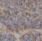 Cullin 4A antibody, FNab02078, FineTest, Immunohistochemistry paraffin image 