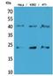Transmembrane Protein 173 antibody, A01871, Boster Biological Technology, Western Blot image 