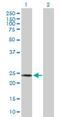 Sperm Autoantigenic Protein 17 antibody, H00053340-B01P, Novus Biologicals, Western Blot image 