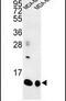 Small Proline Rich Protein 1B antibody, PA5-26062, Invitrogen Antibodies, Western Blot image 