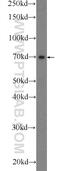 SH3 Domain Containing 21 antibody, 25767-1-AP, Proteintech Group, Western Blot image 