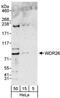 WD Repeat Domain 26 antibody, NBP1-26630, Novus Biologicals, Western Blot image 