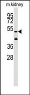 Aldehyde dehydrogenase family 1 member A3 antibody, AP14684PU-N, Origene, Western Blot image 