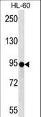 Zinc Finger Protein 227 antibody, LS-C160841, Lifespan Biosciences, Western Blot image 