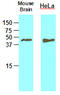 Tomoregulin-2 antibody, LS-C93807, Lifespan Biosciences, Western Blot image 