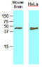 Transmembrane Protein With EGF Like And Two Follistatin Like Domains 2 antibody, LS-C93807, Lifespan Biosciences, Western Blot image 