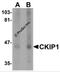 Pleckstrin Homology Domain Containing O1 antibody, 5435, ProSci Inc, Western Blot image 