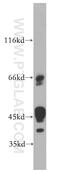 Interleukin 20 Receptor Subunit Beta antibody, 20521-1-AP, Proteintech Group, Western Blot image 