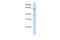 RNA Binding Motif Protein 39 antibody, 25-628, ProSci, Western Blot image 