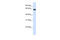 Solute Carrier Family 39 Member 4 antibody, 25-924, ProSci, Western Blot image 