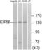 Eukaryotic Translation Initiation Factor 5B antibody, LS-C119970, Lifespan Biosciences, Western Blot image 