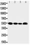Solute Carrier Family 16 Member 4 antibody, PA5-80008, Invitrogen Antibodies, Western Blot image 