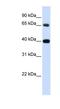 Thymopoietin antibody, NBP1-59489, Novus Biologicals, Western Blot image 