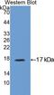 Insulin Like Growth Factor Binding Protein 3 antibody, LS-C301660, Lifespan Biosciences, Western Blot image 