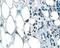 Fibroblast Growth Factor 3 antibody, AF1206, R&D Systems, Immunohistochemistry paraffin image 