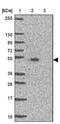 Transmembrane Protein 237 antibody, NBP2-33656, Novus Biologicals, Western Blot image 