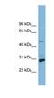 Solute Carrier Family 16 Member 1 antibody, NBP1-59879, Novus Biologicals, Western Blot image 