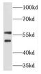 T-Complex 11 antibody, FNab08566, FineTest, Western Blot image 