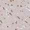 ATP Binding Cassette Subfamily A Member 2 antibody, NBP2-14249, Novus Biologicals, Immunohistochemistry paraffin image 