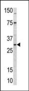 Mitochondrial Ribosomal Protein L24 antibody, PA5-11776, Invitrogen Antibodies, Western Blot image 