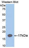 Interleukin 1 Receptor Antagonist antibody, LS-C294796, Lifespan Biosciences, Western Blot image 