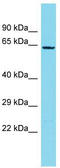 Neuron Derived Neurotrophic Factor antibody, TA330736, Origene, Western Blot image 