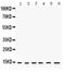 Histidine Triad Nucleotide Binding Protein 1 antibody, PB9632, Boster Biological Technology, Western Blot image 