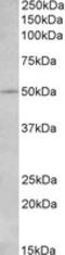 Interleukin 7 Receptor antibody, MBS422817, MyBioSource, Western Blot image 