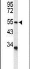 Acid Sensing Ion Channel Subunit 1 antibody, PA5-26278, Invitrogen Antibodies, Western Blot image 